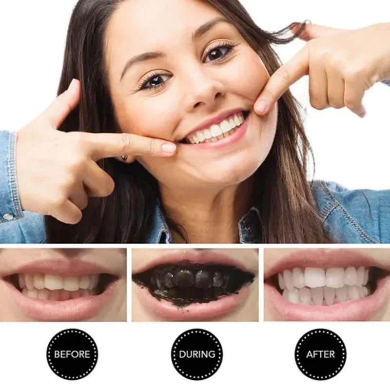 Teeth Whitening Charcoal Powder (Organic) (30g)